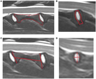 Cervical Intervertebral Disk to Vertebral Body Ratios of Different Dog Breeds Based on Sagittal Magnetic Resonance Imaging